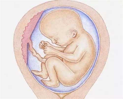 造成胎儿畸形的6大主要因试管婴儿网素，孕妈提前知道提防，稳过