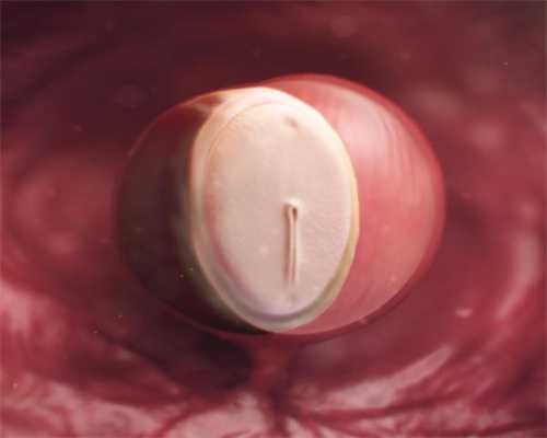 子宫肌瘤是怎样形成的_避孕套针筒助孕几率