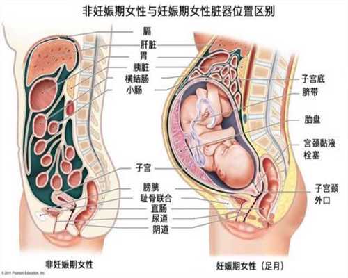 代怀孕初期会有哪些症状？只有呕吐吗？这个知