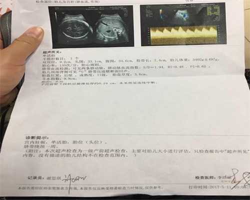 广州代孕可以在医院做吗,孕期会发生头疼是正常