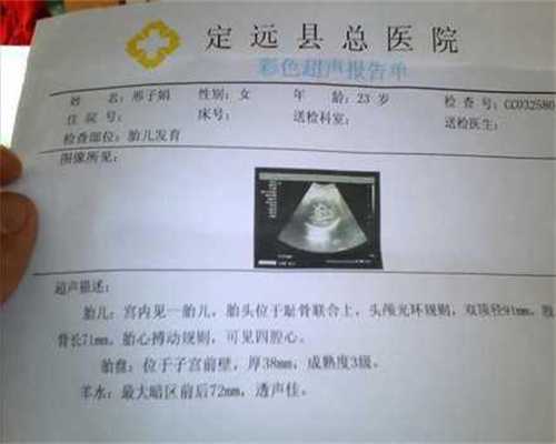 广州代孕一般多少钱,妇科中医子宫好的人，面部