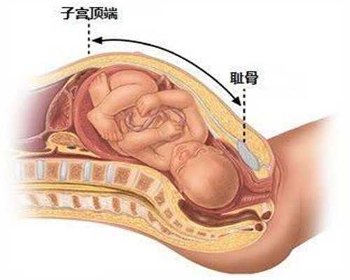 想找个广州代孕妈妈,蛋鸡养殖终极杀手—输卵管