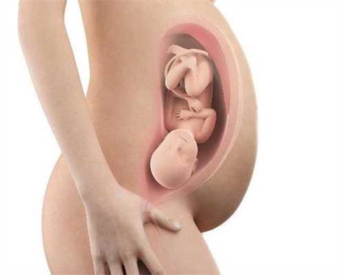 提升早孕试纸检查准确率的五大要点
