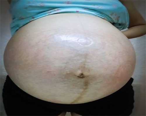 深圳代孕医院,宫外孕导致一侧输卵管切除了，还