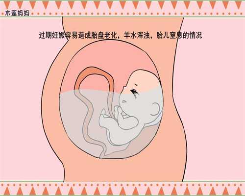 国内代孕靠谱吗-试管婴儿代孕可以吗-孕前需要做